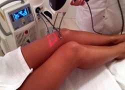 Удаление нежелательных волос в Киеве