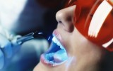 Ультрасовременная техника отбеливания зубов